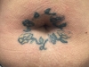 belly button before repair
